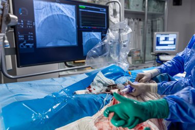 Denizli Türkiye-28 Şubat 2024; Doktorlar bir tanı operasyonu yürüttüler. Koronarografi. Perkütan koroner müdahale analizi, balon anjiyoplasti ve sol koroner arterin stenti..