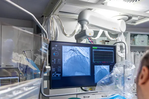 stock image Denizli Turkey-28 February 2024; Doctors conduct a diagnostic operation.Coronarography.Percutaneous coronary intervention-recanalization, balloon angioplasty and stenting of the left coronary artery.