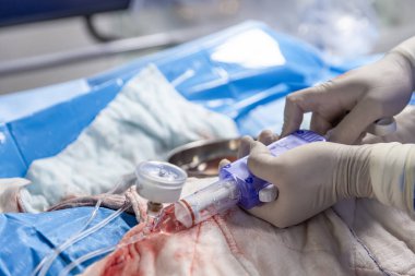 Ameliyathanede kalp stent yerleştirme işlemi. Kalp doktoru merkezi venöz kateter takıyor, şahdamarı kateterize ediyor. Şahdamarına merkezi venöz kateter yerleştiriliyor..