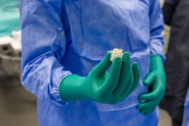 Hastanedeki hastanın kalp kapakçığı (kalp kapakçığı) cerrahi kardiyolojisi. Doktorun elinde Transkateter aort kapakçığı implantasyonunu hazırlayın. Hastanedeki hastanın kalp kapakçığı ameliyatı kardiyolojisi..