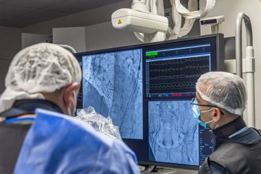 İstanbul, Türkiye 29 Şubat 2024; Melodi kapakçığı ile kapakçık değişimi için röntgen. Kalp kapakçığının mekanik kapakçığı ile mitral kapakçık değişimi olan hastada fonksiyon bozukluğu görülüyor..