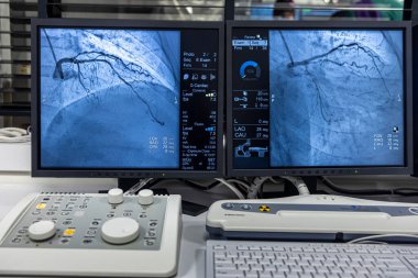 İstanbul, Türkiye 28 Şubat 2024; Koroner arterlerin sağlığını göstermek için arterlere yerleştirilen bir tüpten enjekte edilen kontrastlı bir madde ile saat yönünde çalışan anjiyogram dizisi