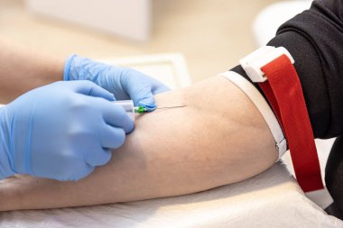 Doktor ya da hemşire boş gezen biriyle kol damarından kan örneği alıyor. Venipunktur ya da venepunktur prosedürü. Laboratuvardaki bir hemşire damardan kan testi yaptırıyor. Yüzü olmayan yakın plan bir plan..