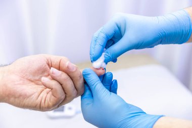 Hastanın kan örneğini parmak batırma kiti ile alan tıbbi çalışanın yakın çekimi. Tıbbi konsept. Diyabet konsepti. Kanında şeker var. Sağlık konsepti. Glikoz ölçer elinde.