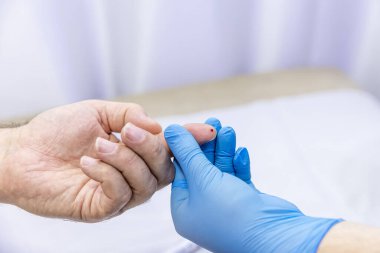 Hastanın kan örneğini parmak batırma kiti ile alan tıbbi çalışanın yakın çekimi. Tıbbi konsept. Diyabet konsepti. Kanında şeker var. Sağlık konsepti. Glikoz ölçer elinde.