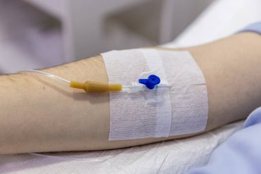 Doktor, hastanın damarına bir iğne sokuyor. Hemşire damar yolu açıyor. Hastanedeki hastaya enjeksiyon hazırlayan ve düzenleyen hemşire. Sağlık hizmetleri kavramı.