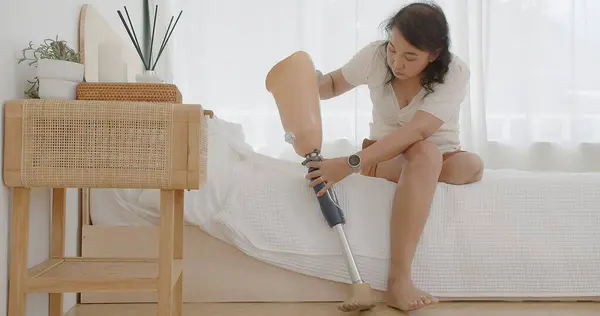 Happy Asian woman walking take a rest and takes off removing prosthetic leg while sitting on bed. Leg prosthetic equipment