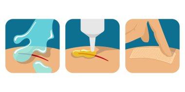 İlk yardım bandı - talimat simgelerini kullanan sıva - yarayı suyla yıka, ilacı uygula ve bir bant tak