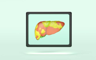 3D x-ray film karaciğeri yeşil arka planda izole edildi. karaciğer sağlığı, yağ hastalığı, hepatit günü konsepti, 3 boyutlu illüstrasyon çizimi
