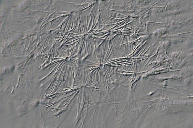 DENDELION - Hafif ve kabarık tohumlar