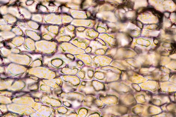 細胞構造花 教室教育のための顕微鏡下の植物細胞におけるクロモプラストの表示 — ストック写真