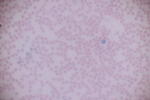 Emberi Vér Szövete Emberi Véna Artéria Emberi Szívizom Humán Mikroszkóp — Stock Fotó
