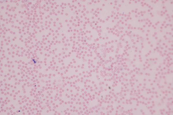 Emberi Vér Szövete Emberi Véna Artéria Emberi Szívizom Humán Mikroszkóp — Stock Fotó