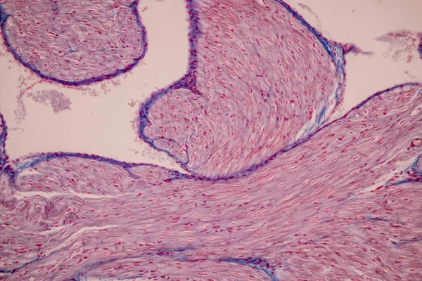 Kan Dokusu Damar Insan Atardamar Insan Kalp Kası Laboratuvarda Mikroskop — Stok fotoğraf