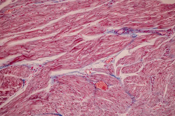 Tissue Blood Human Vein Human Artery Human Heart Muscle Human — Stock Photo, Image