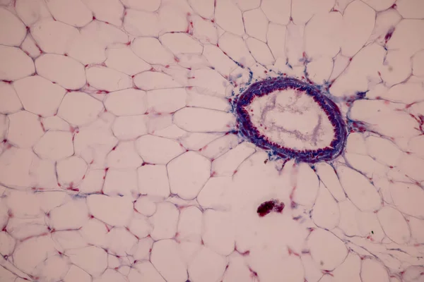 Kan Dokusu Damar Insan Atardamar Insan Kalp Kası Laboratuvarda Mikroskop — Stok fotoğraf
