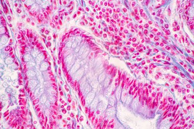 Mide İnsanı, İnce bağırsak İnsanı, Pankreas İnsanı ve İnce bağırsak İnsanı 'nın Özellikleri Laboratuvarda mikroskop altında.