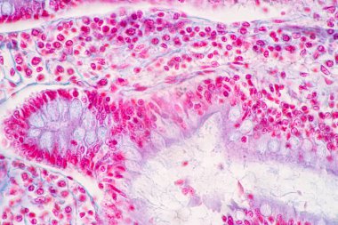 Mide İnsanı, İnce bağırsak İnsanı, Pankreas İnsanı ve İnce bağırsak İnsanı 'nın Özellikleri Laboratuvarda mikroskop altında.