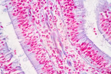 Mide İnsanı, İnce bağırsak İnsanı, Pankreas İnsanı ve İnce bağırsak İnsanı 'nın Özellikleri Laboratuvarda mikroskop altında.