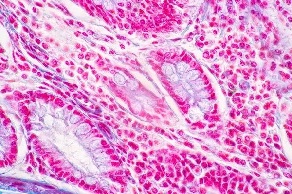 Sfondi Caratteristiche Tessuto Dello Stomaco Umano Intestino Tenue Umano Pancreas — Foto Stock