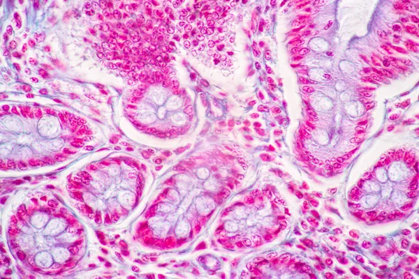 Фокус Характеристики Tissue Stomach Human Small Intestine Human Pancreas Human — стокове фото