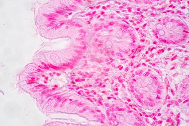 Mide İnsanı, İnce bağırsak İnsanı, Pankreas İnsanı ve İnce bağırsak İnsanı 'nın Özellikleri Laboratuvarda mikroskop altında.