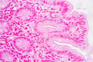 Mide İnsanı, İnce bağırsak İnsanı, Pankreas İnsanı ve İnce bağırsak İnsanı 'nın Özellikleri Laboratuvarda mikroskop altında.