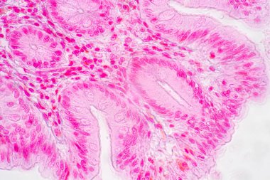 Mide İnsanı, İnce bağırsak İnsanı, Pankreas İnsanı ve İnce bağırsak İnsanı 'nın Özellikleri Laboratuvarda mikroskop altında.