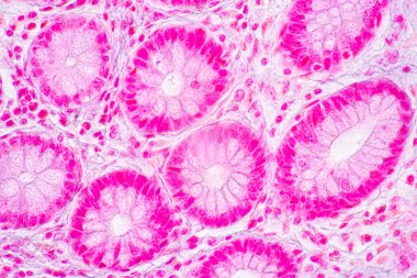 Mide İnsanı, İnce bağırsak İnsanı, Pankreas İnsanı ve İnce bağırsak İnsanı 'nın Özellikleri Laboratuvarda mikroskop altında.