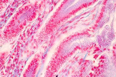 Mide İnsanı, İnce bağırsak İnsanı, Pankreas İnsanı ve İnce bağırsak İnsanı 'nın Özellikleri Laboratuvarda mikroskop altında.