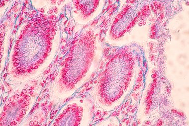 Mide İnsanı, İnce bağırsak İnsanı, Pankreas İnsanı ve İnce bağırsak İnsanı 'nın Özellikleri Laboratuvarda mikroskop altında.