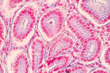 Mide İnsanı, İnce bağırsak İnsanı, Pankreas İnsanı ve İnce bağırsak İnsanı 'nın Özellikleri Laboratuvarda mikroskop altında.