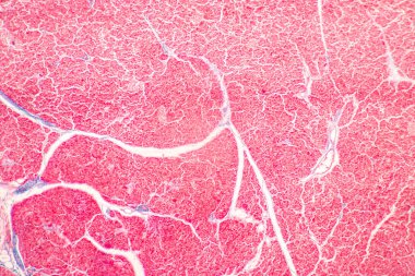 Mide İnsanı, İnce bağırsak İnsanı, Pankreas İnsanı ve İnce bağırsak İnsanı 'nın Özellikleri Laboratuvarda mikroskop altında.