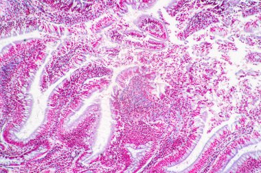 Mide İnsanı, İnce bağırsak İnsanı, Pankreas İnsanı ve İnce bağırsak İnsanı 'nın Özellikleri Laboratuvarda mikroskop altında.