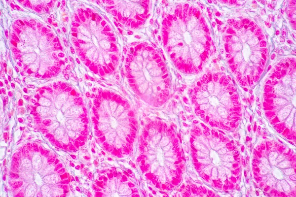 Фокус Характеристики Tissue Stomach Human Small Intestine Human Pancreas Human — стокове фото