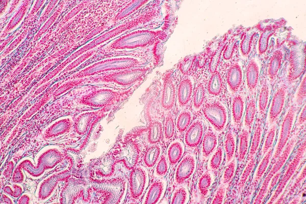 Backgrounds Characteristics Tissue Stomach Human Small Intestine Human Pancreas Human — Stock Photo, Image