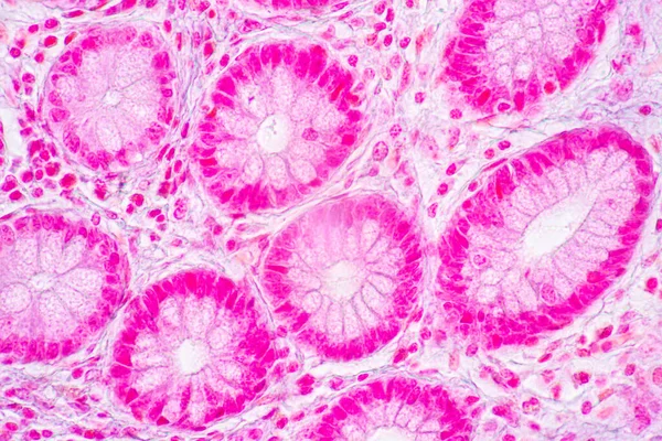 研究室の顕微鏡下における胃ヒト 膵臓ヒト 大腸の特徴の背景 ストックフォト
