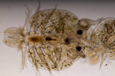 Parazitin (Argulus sp) desenleri ve arkaplanları. Ve (Clinostomum sp. ), Argulus sp. Ve Clinostomum sp. Laboratuvarda mikroskop altında.