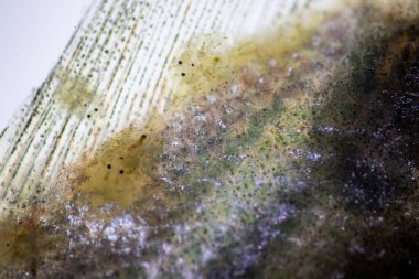 Parazitin (Argulus sp) desenleri ve arkaplanları. Ve (Clinostomum sp. ), Argulus sp. Ve Clinostomum sp. Laboratuvarda mikroskop altında.