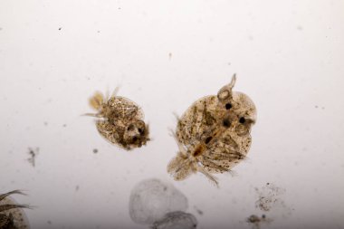 Parazitin (Argulus sp) desenleri ve arkaplanları. Ve (Clinostomum sp. ), Argulus sp. Ve Clinostomum sp. Laboratuvarda mikroskop altında.