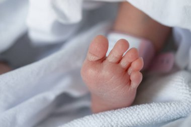 Bu bir dermatit küçük siğil şişlikleri çocukta görünür..