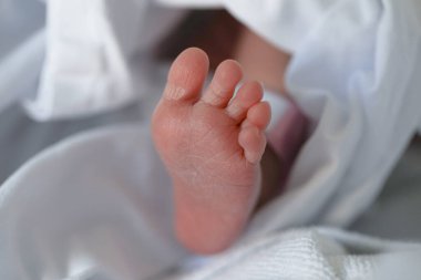 Bu bir dermatit küçük siğil şişlikleri çocukta görünür..