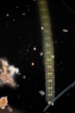 Study of protozoa and plant cells under the microscope for education.