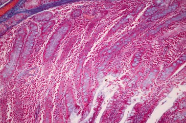 Tissue of Small intestine (Duodenum), Large intestine Human and Stomach Human under the microscope in Lab.