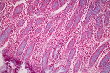 Tissue of Small intestine (Duodenum), Large intestine Human and Stomach Human under the microscope in Lab.