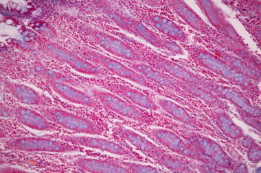Tissue of Small intestine (Duodenum), Large intestine Human and Stomach Human under the microscope in Lab.
