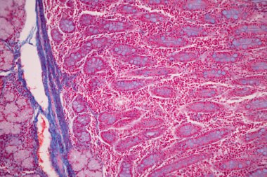Tissue of Small intestine (Duodenum), Large intestine Human and Stomach Human under the microscope in Lab.
