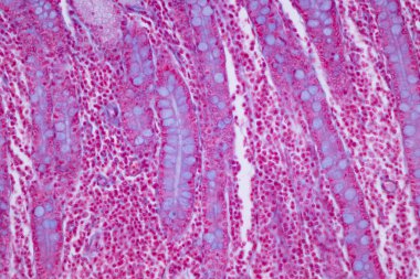 Tissue of Small intestine (Duodenum), Large intestine Human and Stomach Human under the microscope in Lab.