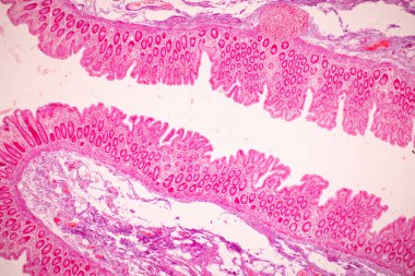 Tissue of Small intestine (Duodenum), Large intestine Human and Stomach Human under the microscope in Lab.