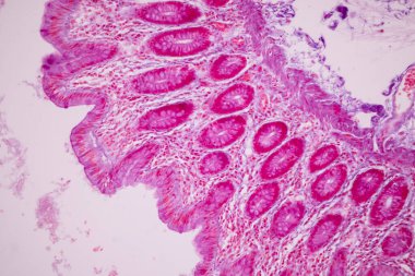 Tissue of Small intestine (Duodenum), Large intestine Human and Stomach Human under the microscope in Lab.